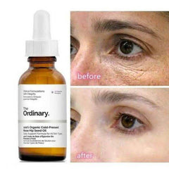 The Ordinary 100% Organic Cold-Pressed Rose Hip Seed Oil in Pakistan - Buy Vitamins