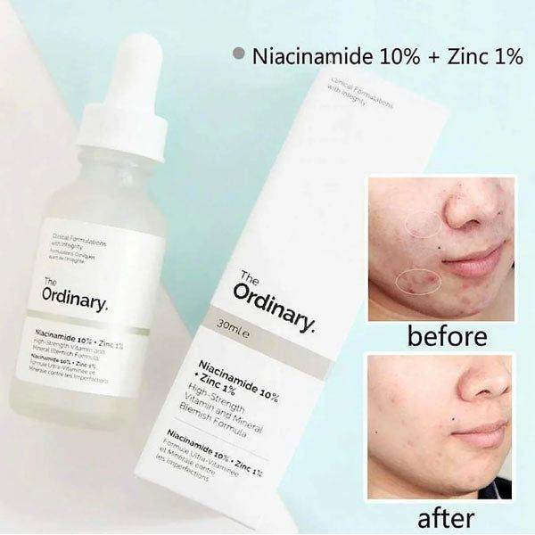 The Ordinary Niacinamide 10% + Zinc 1% 30ml in Pakistan - Buy Vitamins